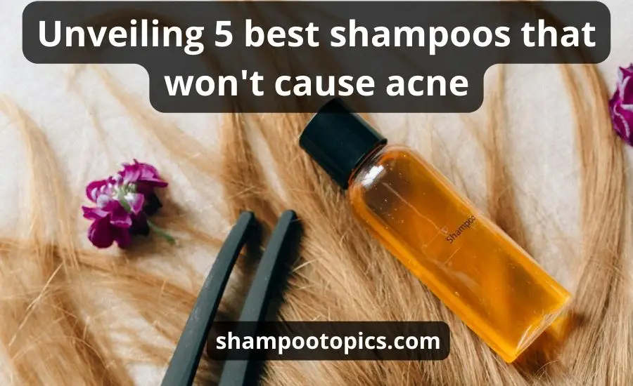 Top 5 The Best Shampoos That Won't Cause Acne: (NEW Guide)